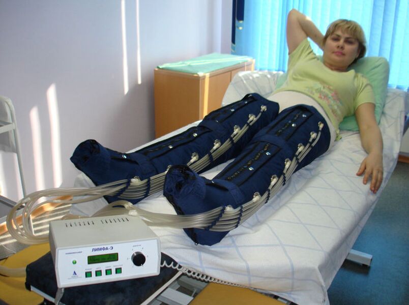 Пресотерапия за лечение на разширени вени на краката