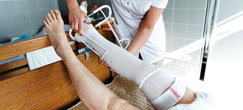 компресионен трикотаж за лечение на разширени вени